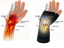 WS6 polsbandage zwart